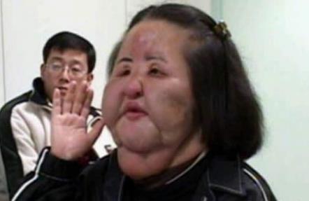 盘点世界上最丑的人