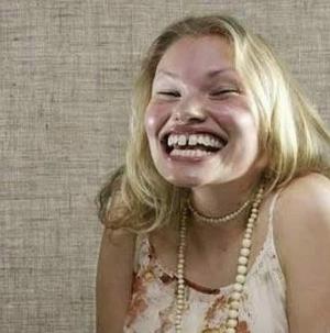 盘点世界上最丑的人