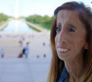 盘点世界上最丑的人