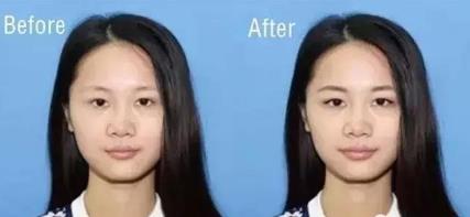 如何不整容也可以让鼻子看起来小小的呢