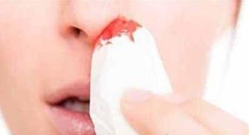 流鼻血禁止做什么 流鼻血禁止做什么