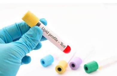 这些食物最适合高血脂的人吃