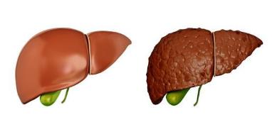 盘点全球五大疾病