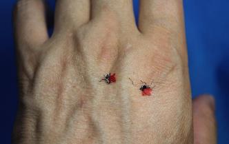 这么多蚊子都在叮着这个人的手 这么多蚊子都在叮着这个人的手