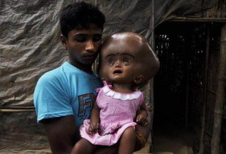 全球7大不寻常的人类