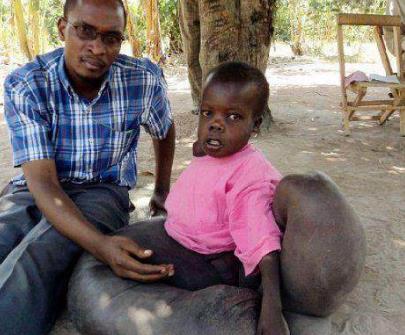 全球7大不寻常的人类 全球7大不寻常的人类