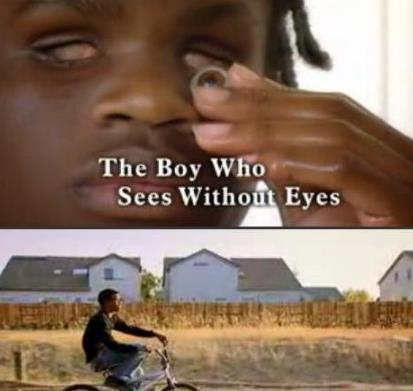 看看这些患有异能综合征的人