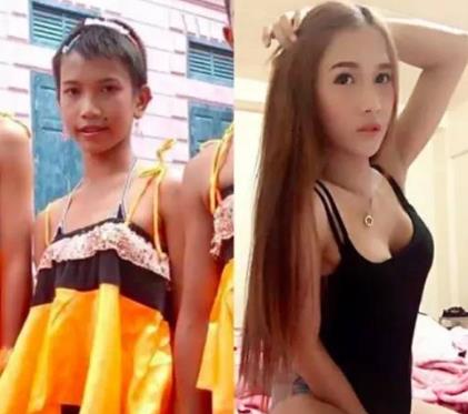 泰国人妖变性前后