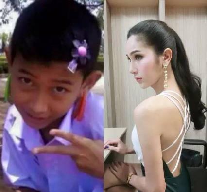 泰国人妖变性前后