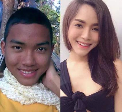 泰国人妖变性前后