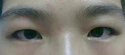 常见的几种眼型 常见的几种眼型