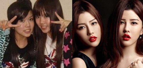 by2整容姐妹花 by2整容姐妹花