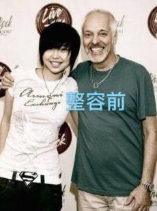 于文文整容前后对比 于文文整容前后对比