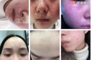 网红骗子周梦晗卖假面膜 网红骗子周梦晗卖假面膜