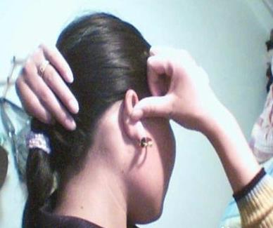 耳朵后面出了个小疙瘩特别疼 耳朵后面出了个小疙瘩特别疼