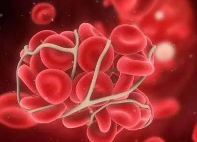 心脏供血不足有什么表现