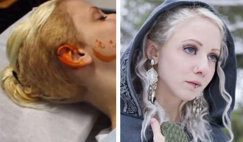 整容界的重口味 整容界的重口味