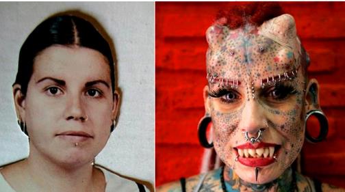 整容界的重口味 整容界的重口味