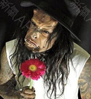 整容界的重口味 整容界的重口味