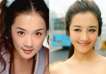 李依晓承认整容：李依晓扶摇剧照