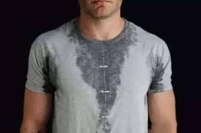 出汗多是什么原因：不同位置出汗多是什么原因