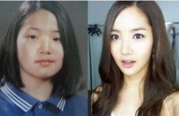 朴敏英整容前:朴敏英男友是谁 朴敏英整容前:朴敏英男友是谁
