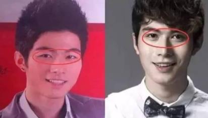 陈学冬为什么叫金丝雀：陈学冬承认整过容对比图