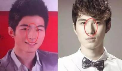 陈学冬为什么叫金丝雀：陈学冬承认整过容对比图