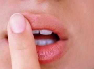 烂嘴角是什么原因:烂嘴角怎么治疗 烂嘴角是什么原因:烂嘴角怎么治疗