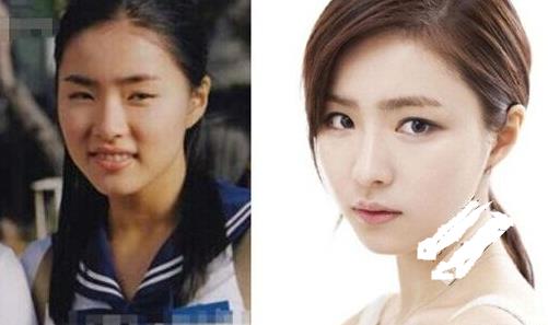 申世京个人资料：申世京整容前后