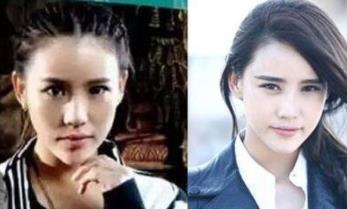 施予斐牙是怎么回事：施予斐整容了吗