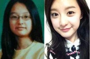 金智媛整容对比：金智媛为什么不红