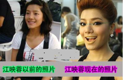 江映蓉整容前后照片：江映蓉和郁可唯分手