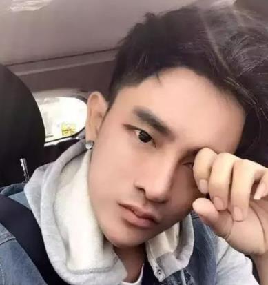 男子因太丑整容30多次：现在的他完美逆袭