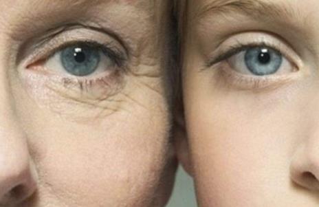 怎样才能有效的去除眼角皱纹，如何防止皱纹产生