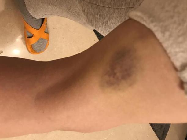 杨洋声援周美毅维权是怎么回事,孩子无辜希望公正解决 杨洋声援周美毅维权是怎么回事,孩子无辜希望公正解决