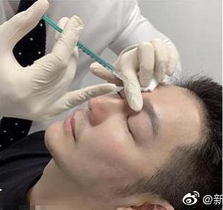 陈浩民公开打针照承认整容,陈浩民为什么要整容 陈浩民公开打针照承认整容,陈浩民为什么要整容