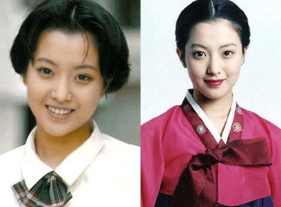 金喜善整容前后对比:后遗症让人害怕