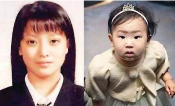 金喜善整容前后对比:后遗症让人害怕