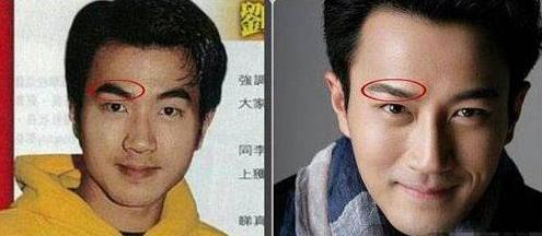 刘恺威整容曝光:刘恺威整容前后对比照