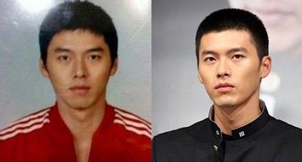 玄彬整容前后对比照:消瘦脸颊凹陷差别巨大