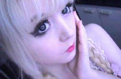 白化病萝莉酷似芭比萝莉:白化病有什么危害?