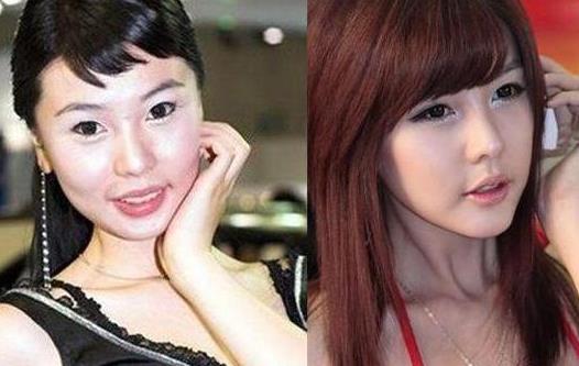 林智慧整容后对比，林智慧个人简历及介绍
