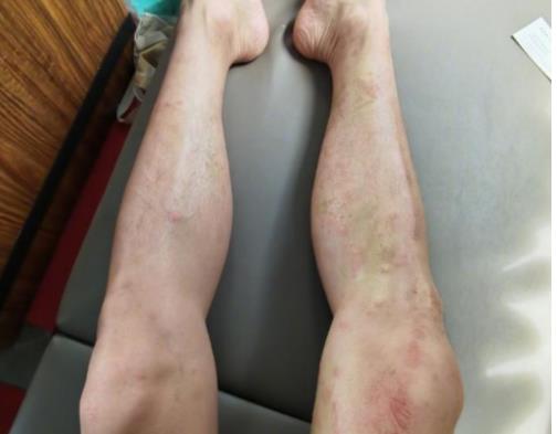 陈学冬被水母蜇成筛子，陈学冬演的电影扮演警察叫什么名字