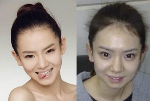 戚薇八卦资料简介：整容前后差别惊人