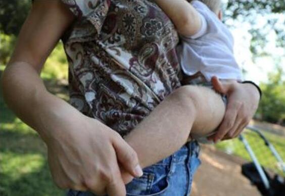 儿童吃错药长毛什么情况 儿童吃错药长毛始末详情介绍