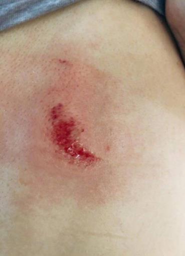 张馨予妈妈受伤是怎么回事 家中柜子突然倒塌妈妈舍身保护