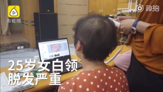 女白领发量剩三成怎么回事 脱发到底应该怎么治