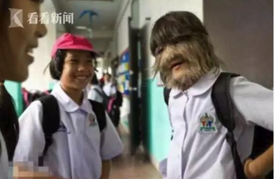 16个孩子变成狼人怎么回事 背后原因曝光让人愤怒