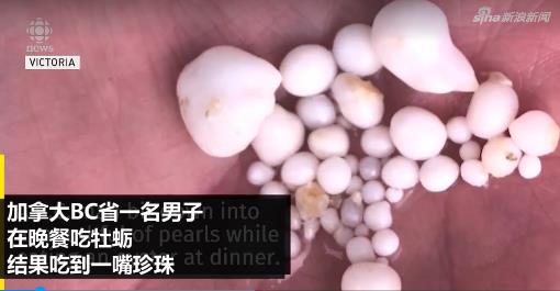 吃牡蛎吐48颗珍珠什么情况 具体详情爆光吓坏众人 吃牡蛎吐48颗珍珠什么情况 具体详情爆光吓坏众人